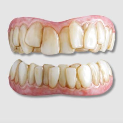 Moonstruck Effects ProFX Grinch Teeth - Handcrafted in Belgium - Made w/Dental Grade Materials - Halloween Costume Teeth, Costume Dentures