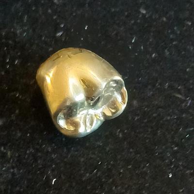 Full metal gold colored cast crown post tooth