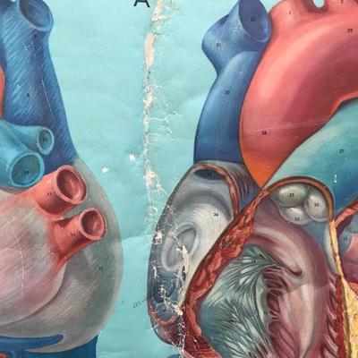 #106 - Vintage Denoyer Geppert Anatomy Series K L 5 "The Heart" Chart