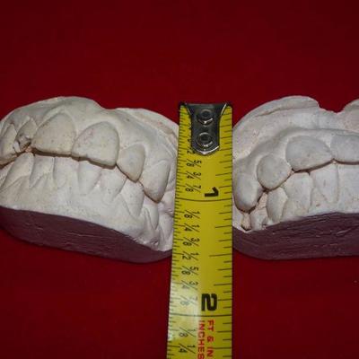 Vintage plaster children kids dental molds (2)