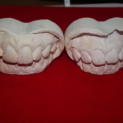 Vintage plaster children kids dental molds (2)