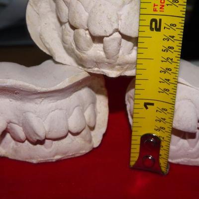 Childs Plaster Dental Molds, Teeth Molds (3)