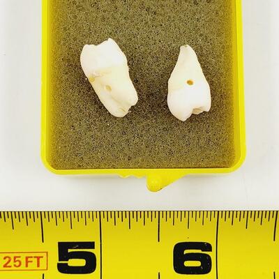 CRAFTY HUMAN MOLARS