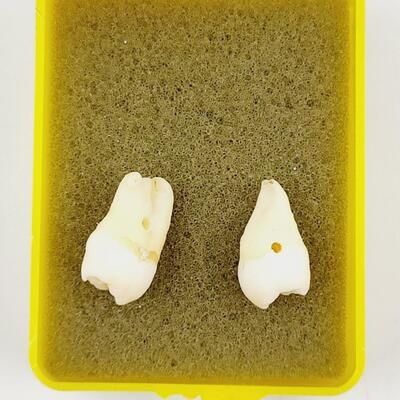 CRAFTY HUMAN MOLARS