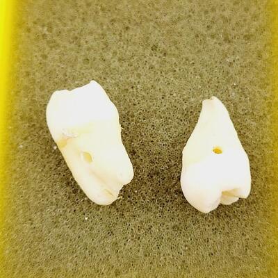 CRAFTY HUMAN MOLARS
