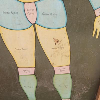 19th Century Medical Teaching Device antique chalk board and wooden folding chair