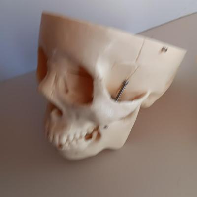 Anatomical Adult Life-Size Skull 4th Qual. CS204 Remove Top Spring Jaw