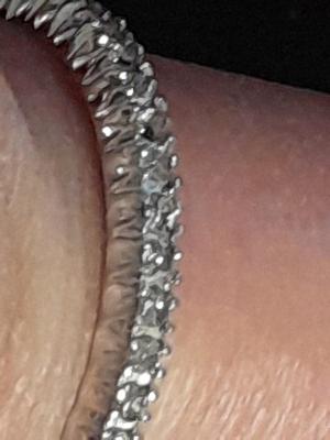Engagement band missing some stones