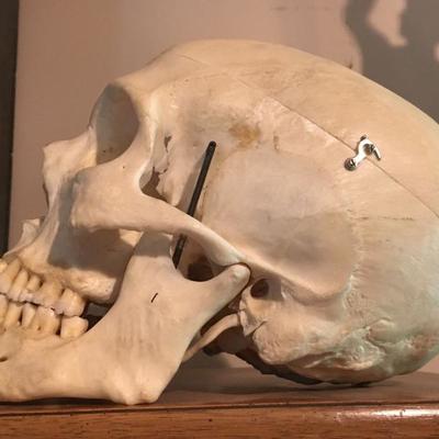 Human Skull prepared for medical use