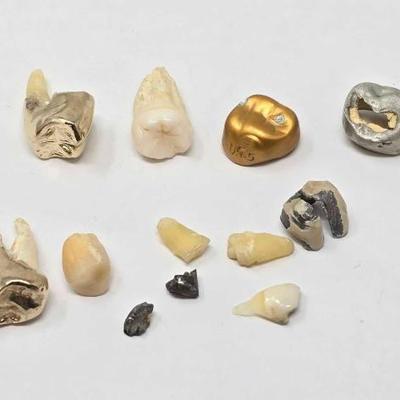 #1826 â€¢ Gold & Silver Capped Teeth, 16.28g
