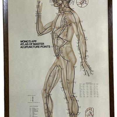 Vintage Acupuncture Points Poster