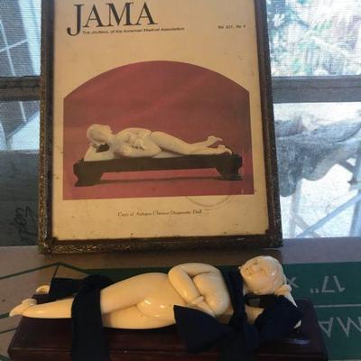 TTT201 - Chinese Doctor’s Diagnostic Doll