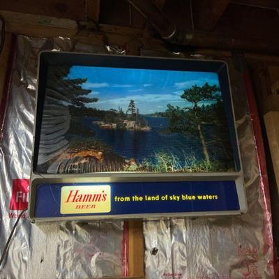 Hamm's sign