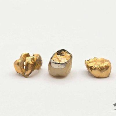 #1222 • Gold & Silver Teeth and Inlays, 5.5g
