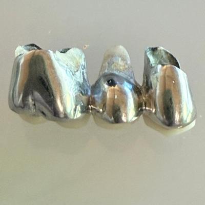 14k White Gold Fillings - Total Weight 8.13 Grams