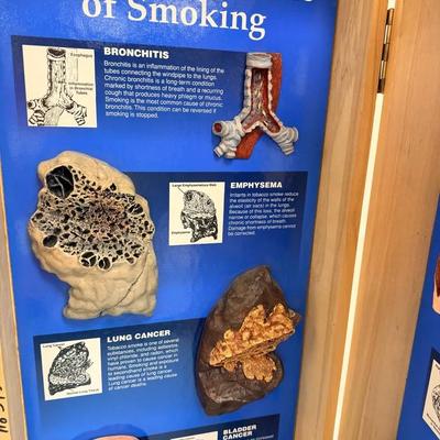 “Consequences Of Smoking” 3D Display